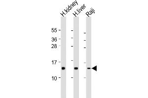 All lanes : Anti-NDUFS5 Antibody (N-Term) at 1:2000 dilution Lane 1: human kidney lysate Lane 2: human liver lysate Lane 3: Raji whole cell lysate Lysates/proteins at 20 μg per lane.