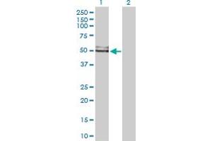 Western Blot analysis of GDI1 expression in transfected 293T cell line by GDI1 MaxPab polyclonal antibody. (GDI1 anticorps  (AA 1-447))