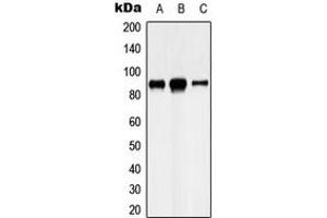 Western blot analysis of Cadherin 8 expression in U87MG (A), HeLa (B), SHSY5Y (C) whole cell lysates. (Cadherin 8 anticorps  (Center))