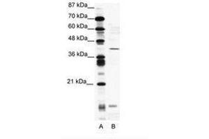 Image no. 1 for anti-CAMP Responsive Element Modulator (CREM) (AA 19-68) antibody (ABIN202021) (CREM anticorps  (AA 19-68))
