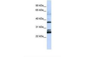 Image no. 1 for anti-Family with Sequence Similarity 70, Member A (FAM70A) (AA 108-157) antibody (ABIN6738344) (FAM70A anticorps  (AA 108-157))