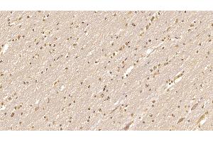 Detection of CDNF in Human Cerebrum Tissue using Monoclonal Antibody to Cerebral Dopamine Neurotrophic Factor (CDNF)