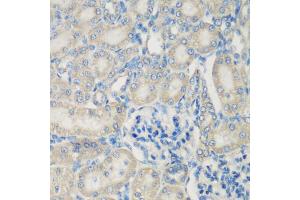 Immunohistochemistry of paraffin-embedded rat kidney using C3 antibody (ABIN5975433) at dilution of 1/200 (40x lens). (C3 anticorps)