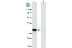 Western Blot analysis of DNAJC27 expression in transfected 293T cell line by DNAJC27 monoclonal antibody (M09), clone 3C1. (DNAJC27 anticorps  (AA 1-273))