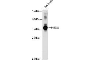 Western blot analysis of extracts of rat brain, using INSIG1 antibody (ABIN7267887) at 1:1000 dilution. (INSIG1 anticorps  (C-Term))