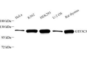 Western blot analysis of GTF3C3 (ABIN7074039) at dilution of 1: 1000