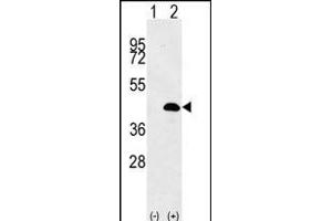 Western blot analysis of LUC7L (arrow) using rabbit polyclonal LUC7L Antibody (Center) (ABIN656137 and ABIN2845476). (LUC7L anticorps  (AA 219-246))