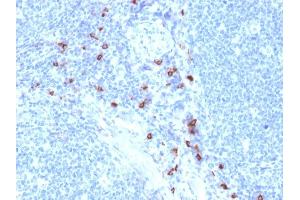 Formalin-fixed, paraffin-embedded human Tonsil stained with Tryptase Mouse Monoclonal Antibody (TPSAB1/1963). (TPSAB1 anticorps  (AA 115-233))