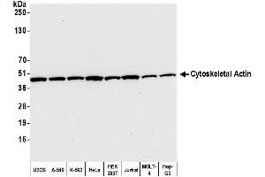 Western Blotting (WB) image for anti-Cytoskeletal Actin (CIMG_00972) (N-Term) antibody (ABIN7453594) (Cytoskeletal Actin (CIMG_00972) (N-Term) anticorps)