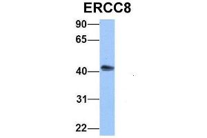 Host:  Rabbit  Target Name:  ERCC8  Sample Type:  Human HepG2  Antibody Dilution:  1.