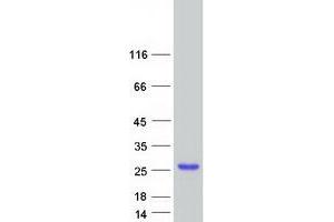 Validation with Western Blot