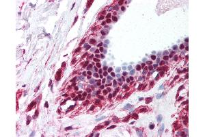 Anti-DDX39B / UAP56 antibody IHC of human breast. (DDX39B anticorps  (C-Term))