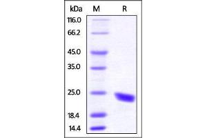 Mouse CD40 Ligand, His Tag on SDS-PAGE under reducing (R) condition. (CD40 Ligand Protein (CD40LG) (AA 115-260) (His tag))