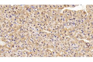 Detection of TH in Rat Adrenal gland Tissue using Polyclonal Antibody to Tyrosine Hydroxylase (TH) (Tyrosine Hydroxylase anticorps  (AA 34-301))