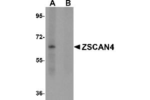 Western Blotting (WB) image for anti-Zinc Finger and SCAN Domain Containing 4 (ZSCAN4) (C-Term) antibody (ABIN1030831) (ZSCAN4 anticorps  (C-Term))