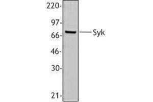 Western Blotting (WB) image for anti-Spleen tyrosine Kinase (SYK) (AA 5-360) antibody (ABIN2665374) (SYK anticorps  (AA 5-360))