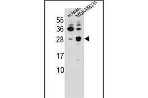 CBLN2 Antibody (C-term) (ABIN655780 and ABIN2845215) western blot analysis in mouse brain tissue and MDA-M cell line lysates (35 μg/lane). (CBLN2 anticorps  (C-Term))