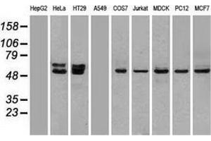 Western blot analysis of extracts (35 µg) from 9 different cell lines by using anti-OXSR1 monoclonal antibody. (OXSR1 anticorps)