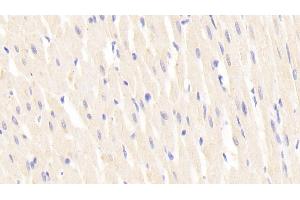 Detection of LAMb2 in Rat Cardiac Muscle Tissue using Polyclonal Antibody to Laminin Beta 2 (LAMb2)
