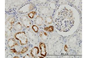 Immunoperoxidase of monoclonal antibody to TIMP2 on formalin-fixed paraffin-embedded human kidney. (TIMP2 anticorps  (AA 27-220))