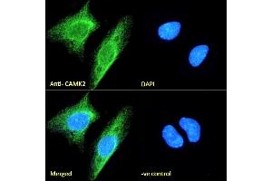 (ABIN570984) Immunofluorescence analysis of paraformaldehyde fixed Neuro2a cells, permeabilized with 0. (CaMKII alpha/beta (Internal Region) anticorps)