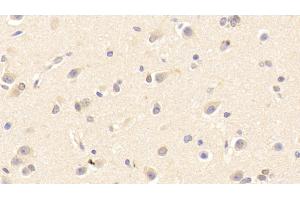 Detection of PRDX4 in Human Cerebrum Tissue using Polyclonal Antibody to Peroxiredoxin 4 (PRDX4)