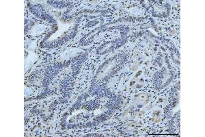 IHC analysis of MRE11 using anti-MRE11 antibody (ABIN7600025). (Mre11 anticorps  (AA 14-481))