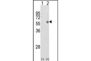 Western blot analysis of CCT3 (arrow) using rabbit polyclonal CCT3 Antibody (Center) (ABIN389422 and ABIN2839505). (CCT3 anticorps  (AA 298-326))