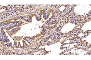 Detection of CTSS in Porcine Lung Tissue using Polyclonal Antibody to Cathepsin S (CTSS) (Cathepsin S anticorps  (AA 115-331))