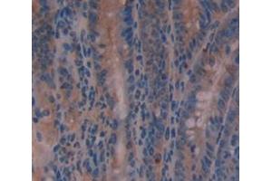 Figure. (TMPRSS2 anticorps  (AA 254-490))