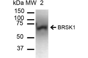 Western blot analysis of Mouse Brain cell lysates showing detection of ~85. (BRSK1 anticorps  (Atto 390))