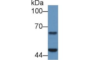 Detection of PSMC4 in Porcine Cerebrum lysate using Polyclonal Antibody to Proteasome 26S Subunit, ATPase 4 (PSMC4)