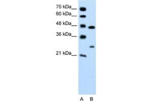 Western Blotting (WB) image for anti-Claudin 18 (CLDN18) antibody (ABIN2462406) (Claudin 18 anticorps)