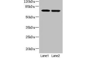 Western blot All lanes: NETO2 antibody at 4 μg/mL Lane 1: U251 whole cell lysate Lane 2: MDA-MB-231 whole cell lysate Secondary Goat polyclonal to rabbit IgG at 1/10000 dilution Predicted band size: 60, 23, 59 kDa Observed band size: 70 kDa (NETO2 anticorps  (AA 378-525))
