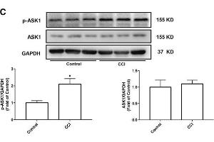 CCI induced neuropathic pain and increased the expression of p-ASK1 in the spinal cord of rats.