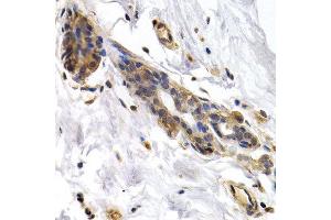 Immunohistochemistry of paraffin-embedded human normal breast using PKLR antibody at dilution of 1:200 (400x lens). (PKLR anticorps)