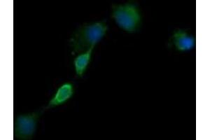 Image no. 2 for anti-Epidermal Growth Factor Receptor (EGFR) antibody (ABIN1497964) (EGFR anticorps)
