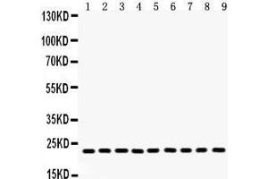 Anti- Peroxiredoxin 1 Picoband antibody, Western blotting All lanes: Anti Peroxiredoxin 1  at 0. (Peroxiredoxin 1 anticorps  (Middle Region))