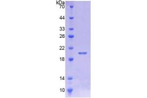 SDS-PAGE analysis of Human CALML5 Protein.