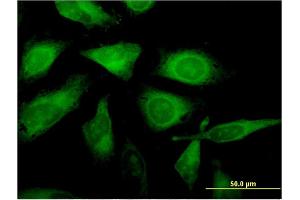 Immunofluorescence of monoclonal antibody to C1orf89 on HeLa cell. (RSG1 anticorps  (AA 1-258))