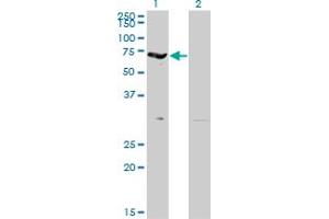 Western Blot analysis of EPB42 expression in transfected 293T cell line by EPB42 monoclonal antibody (M01), clone 2G12. (EPB42 anticorps  (AA 623-721))