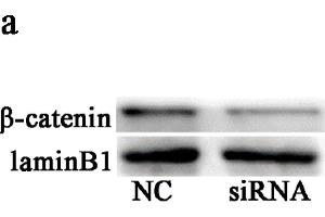Knockdown of BAMBI suppressed Wnt/β-catenin signaling. (beta Catenin anticorps  (AA 661-781))
