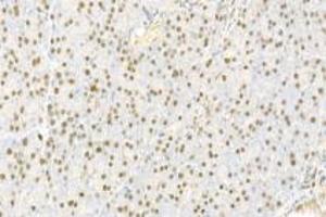 Immunohistochemistry analysis of paraffin-embedded rat pancreas using,IOP2 (ABIN7074883) at dilution of 1: 2000 (NARF anticorps)