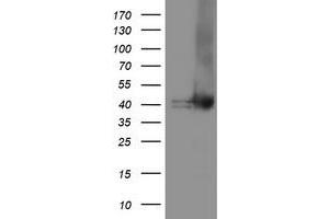 Western Blotting (WB) image for anti-Tubulin Folding Cofactor C (TBCC) antibody (ABIN1501322) (TBCC anticorps)