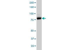 EPS8L2 monoclonal antibody (M01), clone 6C2 Western Blot analysis of EPS8L2 expression in A-431 .