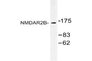 Western blot (WB) analysis of NMDAR2B antibody in extracts from Jurkat cells. (GRIN2B anticorps)