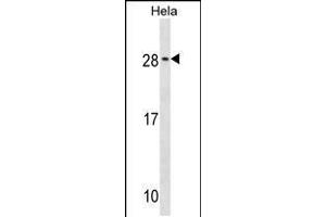 Western blot analysis in Hela cell line lysates (35ug/lane). (RAB35 anticorps  (C-Term))