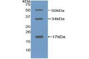 Detection of Recombinant COL10, Mouse using Polyclonal Antibody to Collagen Type X (COL10)