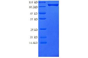 Colony Stimulating Factor 3 Receptor (Granulocyte) (CSF3R) (AA 25-620) protein (GST tag)