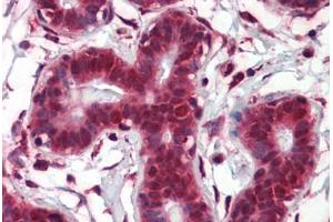 Human Breast (formalin-fixed, paraffin-embedded) stained with NOTCH4 antibody ABIN462184 followed by biotinylated goat anti-rabbit IgG secondary antibody ABIN481713, alkaline phosphatase-streptavidin and chromogen.